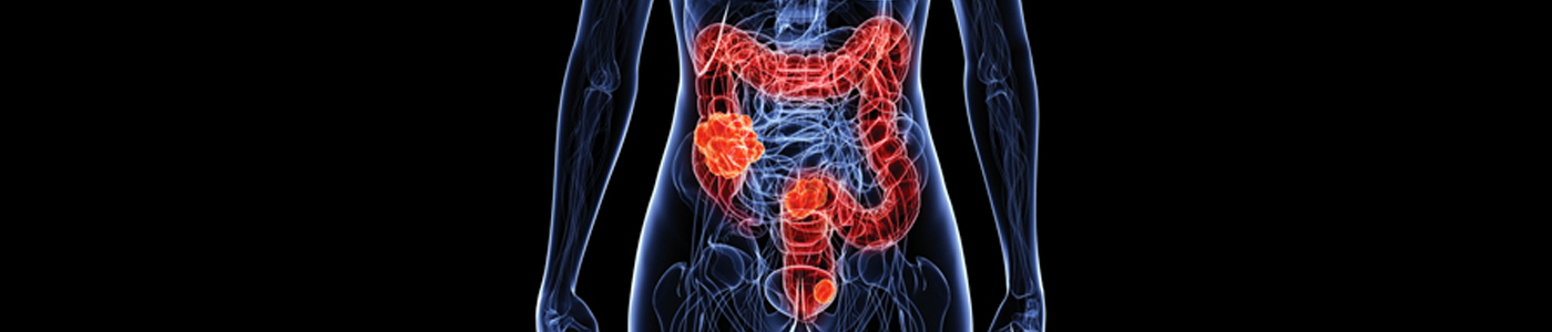 large intestine colon