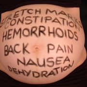 haemorrhoids in pregnancy